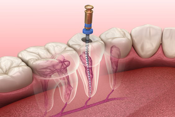 EndodontiaResized